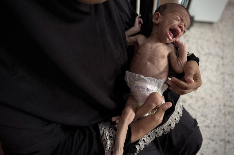 A starving child